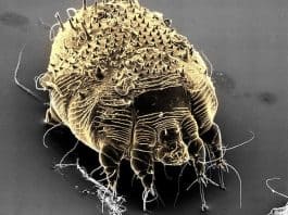 A Scabies Mite. (Photo courtesy WebMD)