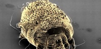 A Scabies Mite. (Photo courtesy WebMD)