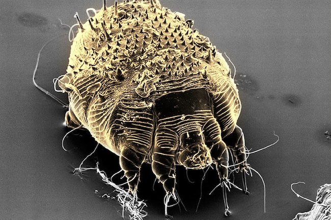 A Scabies Mite. (Photo courtesy WebMD)