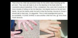 The social media post showing the child's burned hands. (Courtesy Facebook)