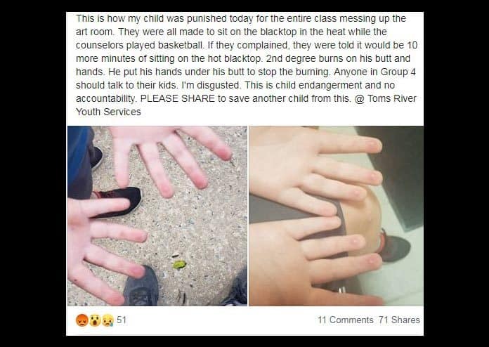 The social media post showing the child's burned hands. (Courtesy Facebook)